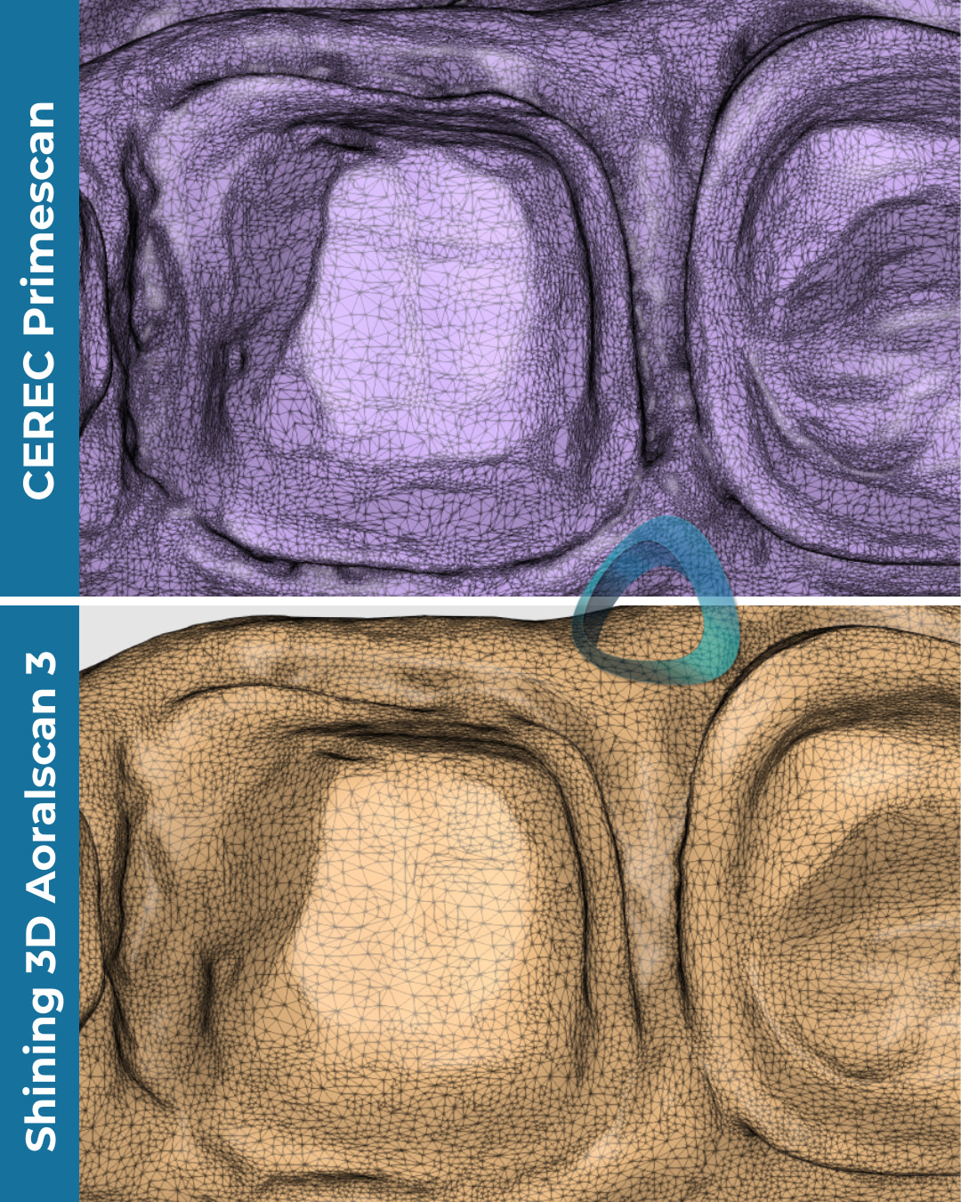 idd-compares-intraoral-scanners-shining3d-aoralscan3-cerec-primescan-tessellated-mesh