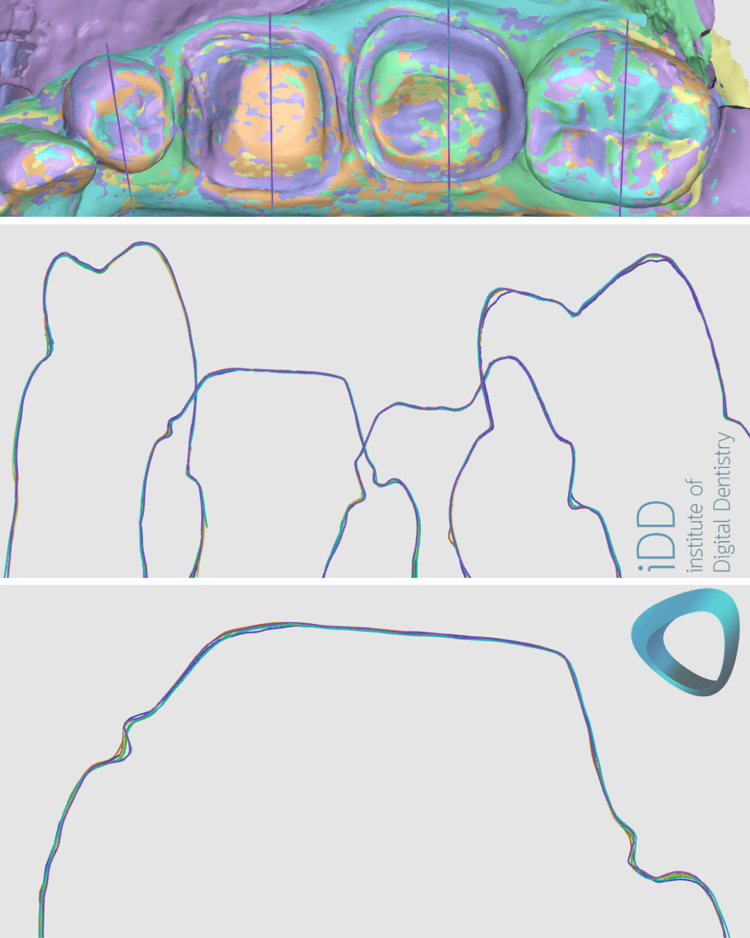 idd-compares-intraoral-scanners-shining3d-aoralscan3-medit-i700-cerec-primescan-helios-600-eighteeth-3disc-heron-ios-launca-dl206p-sectional-view