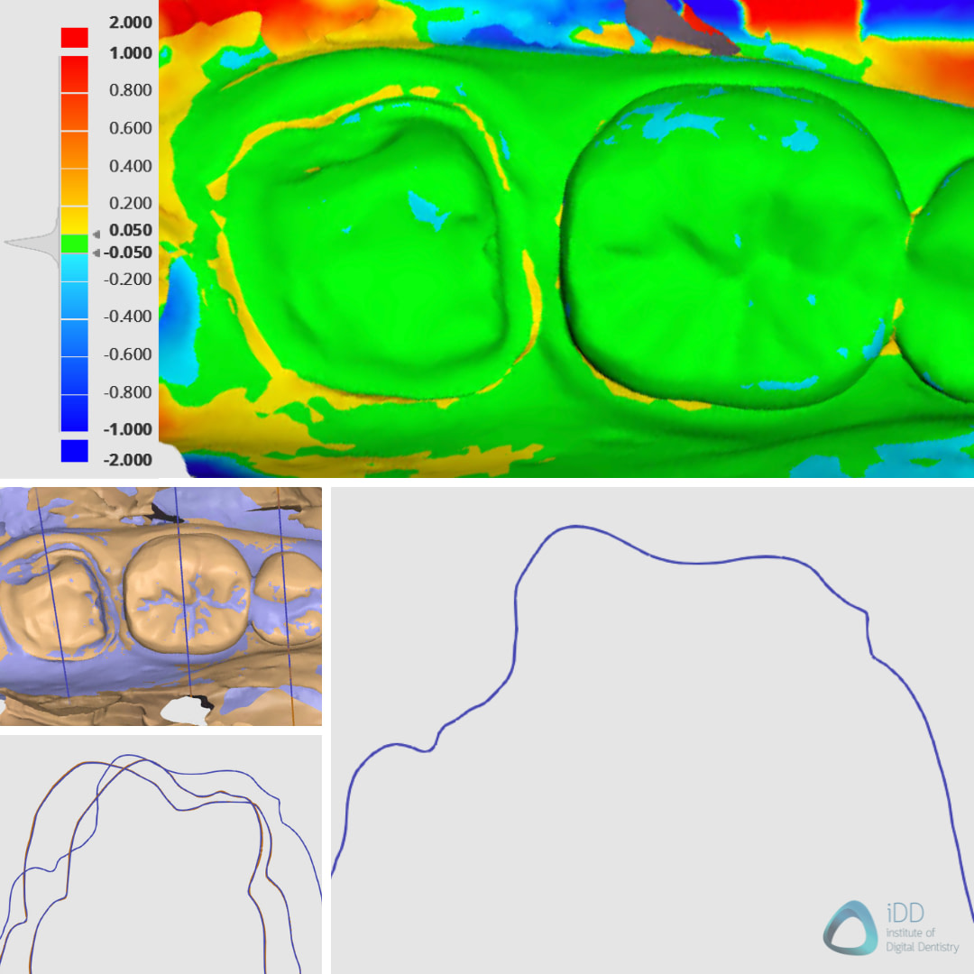 idd-compares-dentsply-sirona-cerec-primescan-straumann-virtuo-vivo-intraoral-scanner-deviation-map-sectional-view-scans