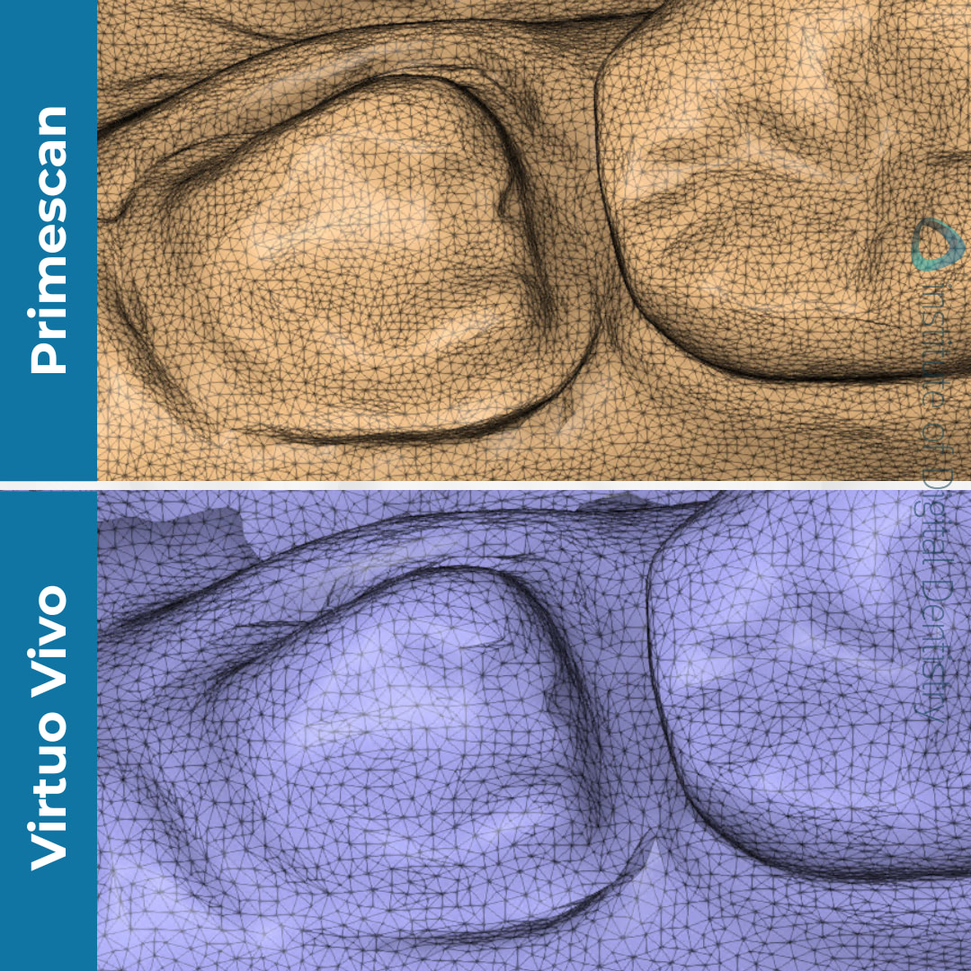 idd-compares-dentsply-sirona-cerec-primescan-straumann-virtuo-vivo-intraoral-scanner-tessellated-mesh-scans
