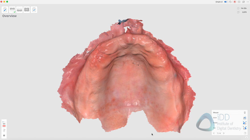 Medit i700 wireless simple UI 2