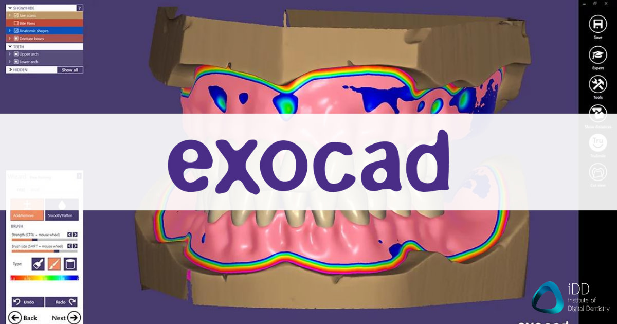 exocad-dentalcad-dental-cad-software-denture-idd
