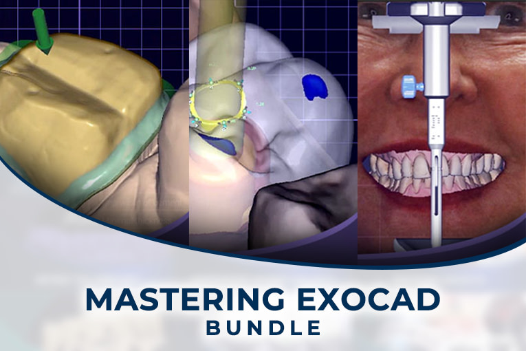 Bundle Spiffy - Mastering exocad