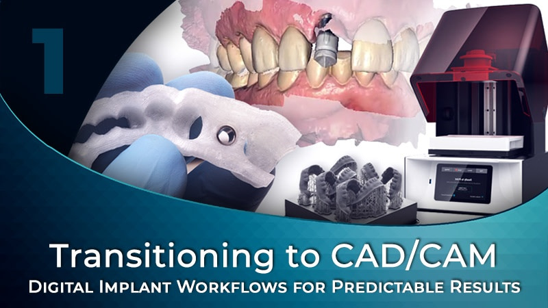 XPfMJkXbQlC226MFg8lo_Digital Implant Workflows for Predictable Results 01 with August de Oliveira Digital_implant_workflow