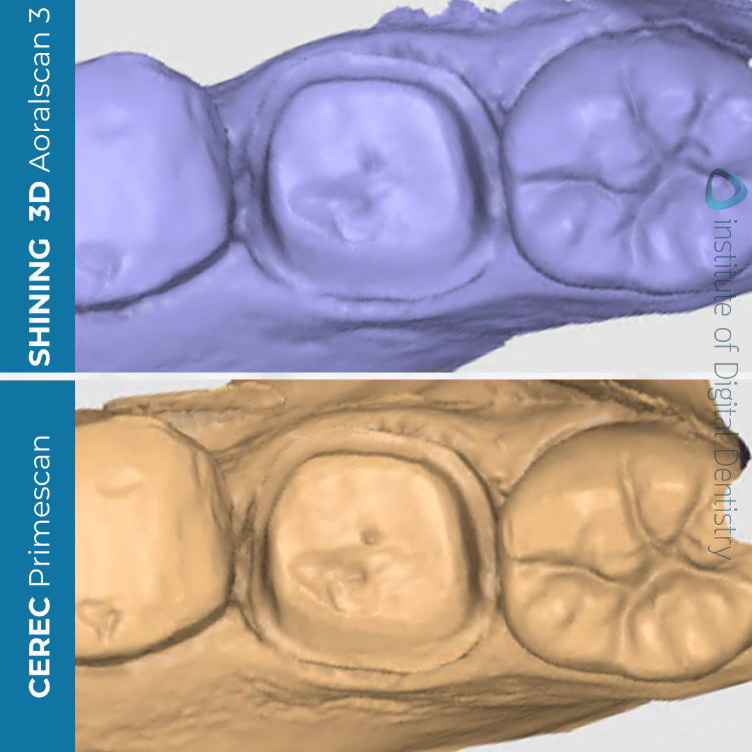 idd-compares-shining-3d-dental-aoralscan-3-dentsply-sirona-cerec-primescan-medit-design-stl-cad-software