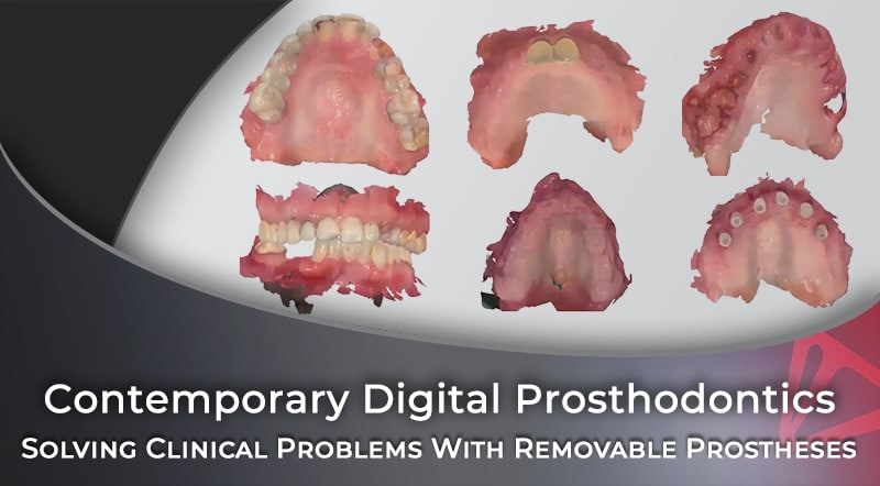 Contemporary Digital Prosthodontics Restoring Real-Life Smiles