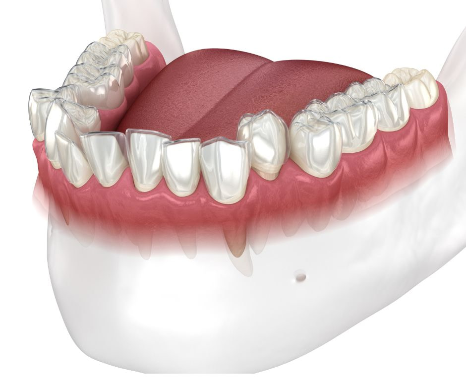 Misshapen or disproportionate teeth