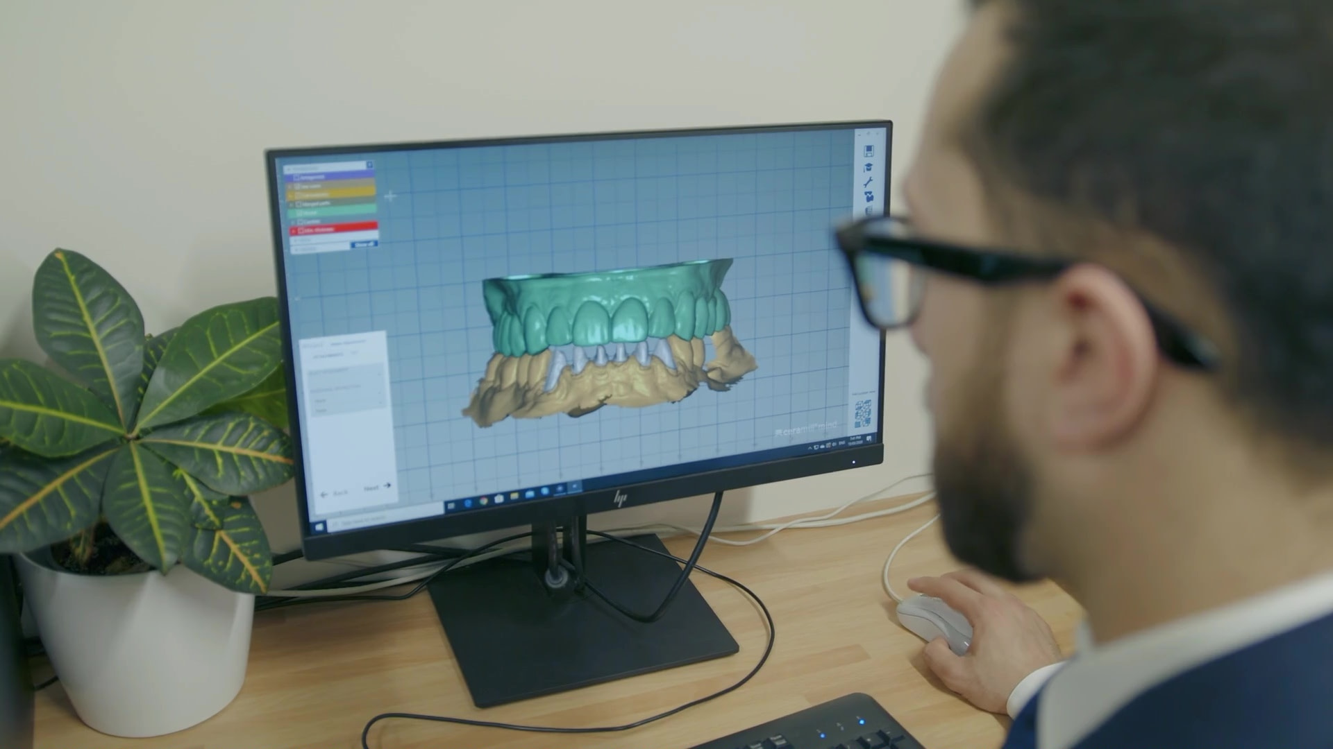 Overview of CAD_CAM Design Fundamentals