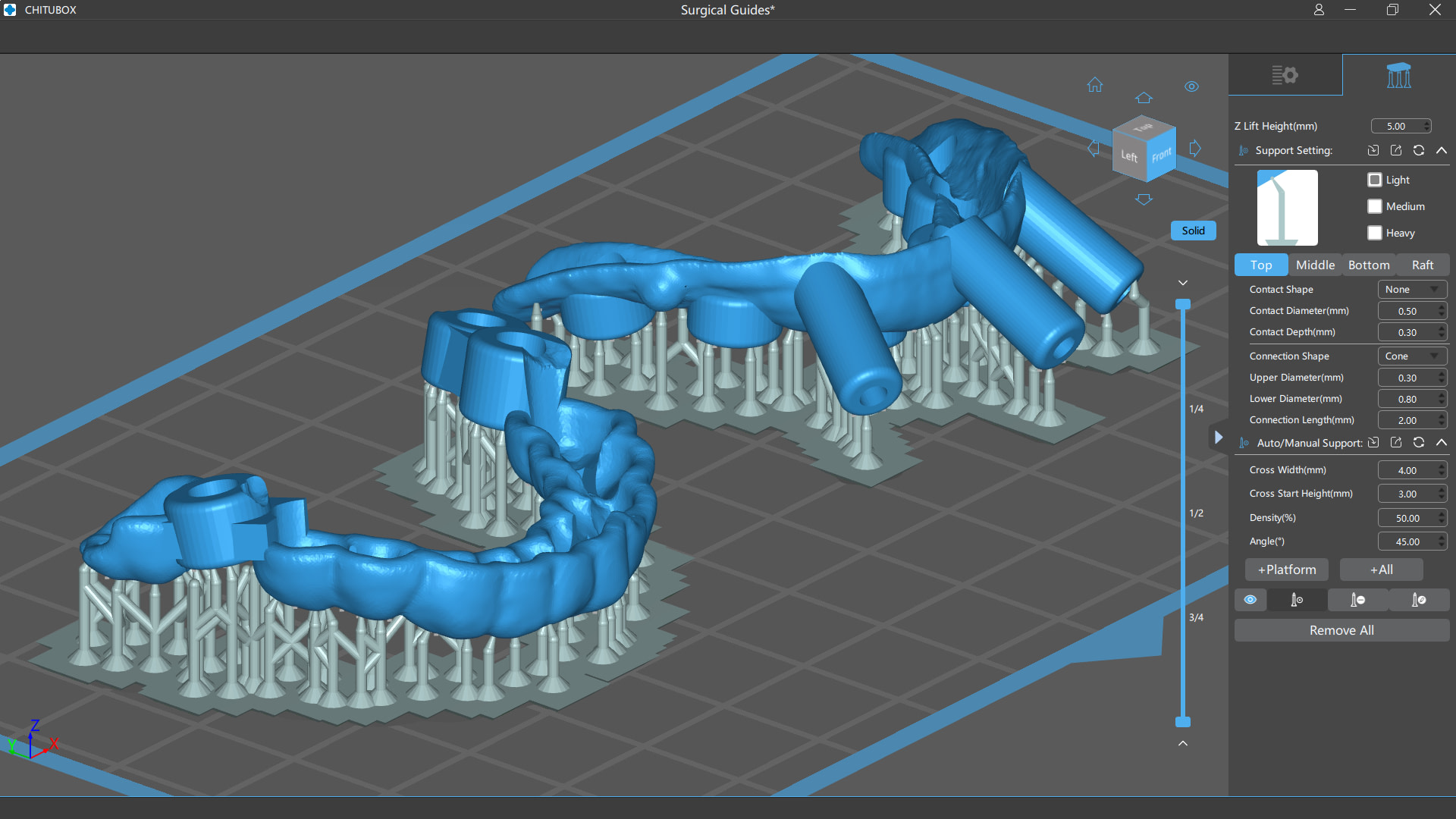 idd-blog-dentafab-sega-3d-printer-slicer-software-chitubox