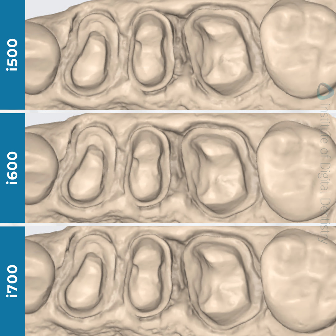 idd-compares-intraoral-scanner-medit-i500-i600-i700-native-processed-monochrome-scans
