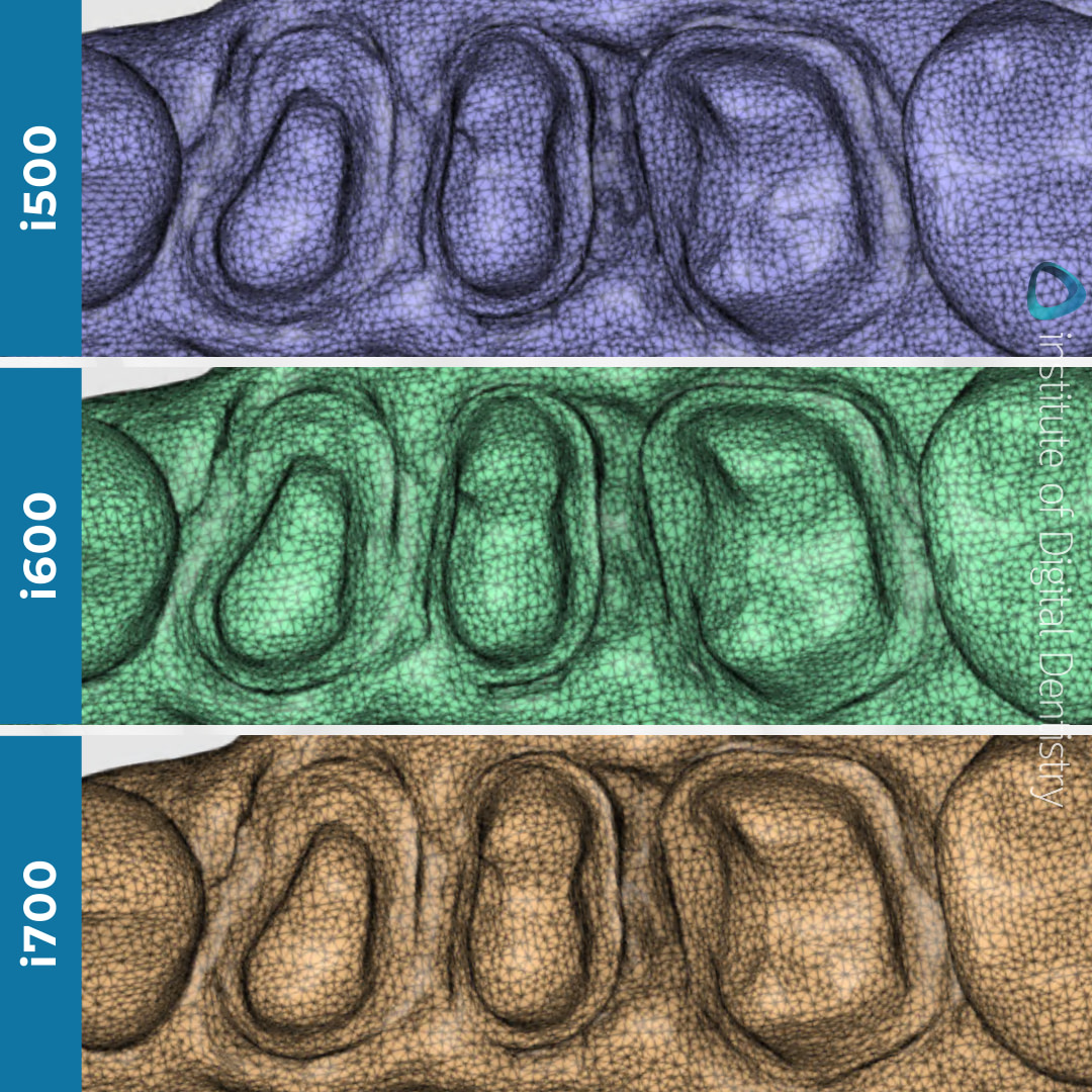 idd-compares-intraoral-scanner-medit-i500-i600-i700-tessellated-mesh-density-accuracy-stl-export-medit-design