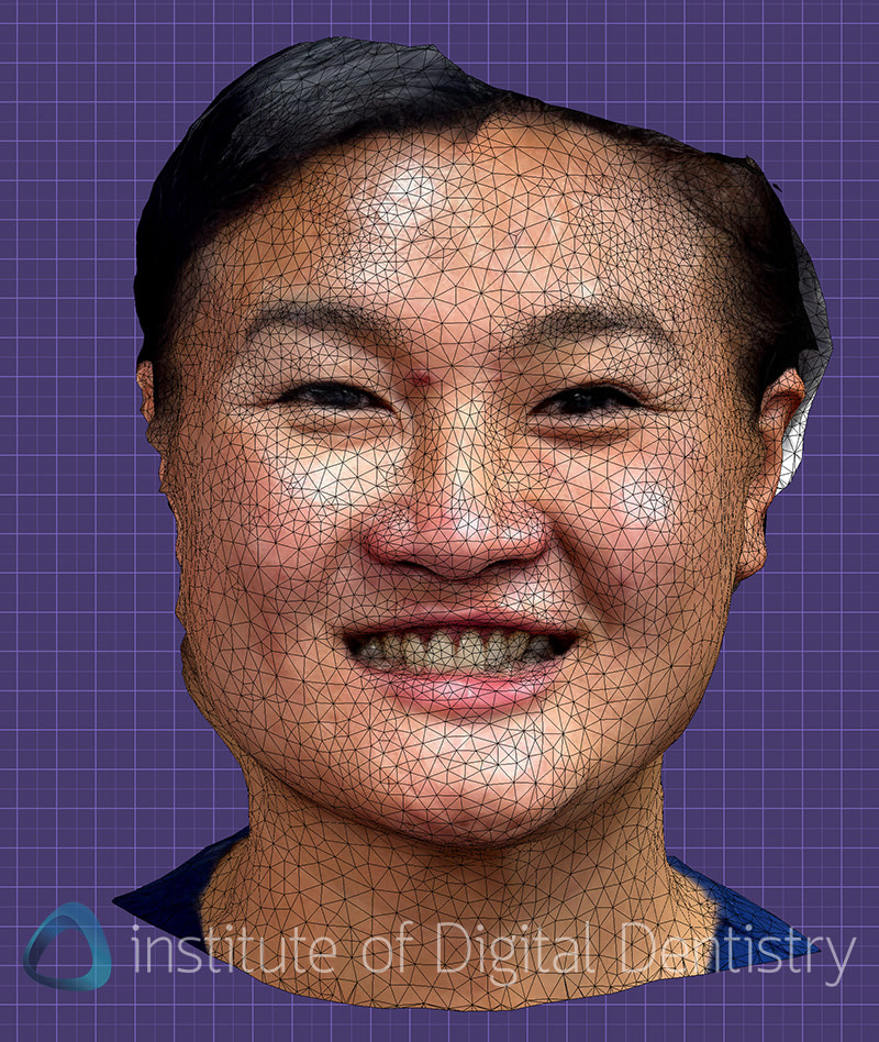 metismile_rayface_qlone_dental_face_scanners (1)