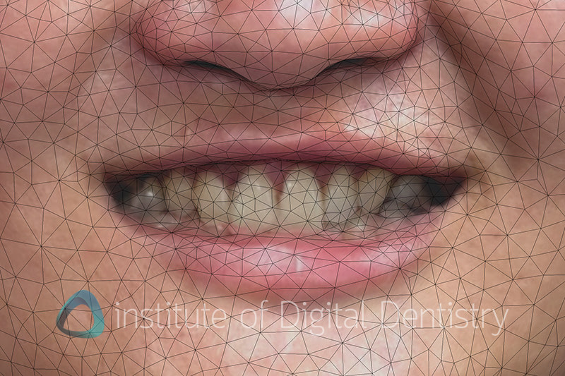 metismile_rayface_qlone_dental_face_scanners (4)