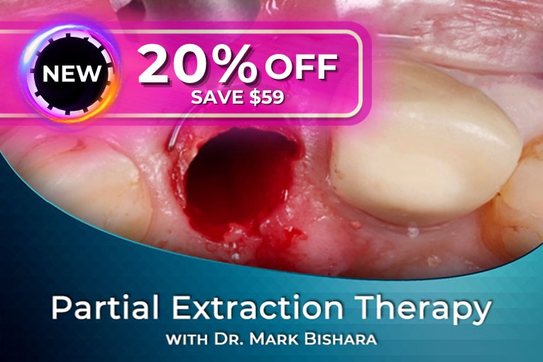 02 Partial-Extraction-Therapy-Mid-Year-Sale-2024-iDD