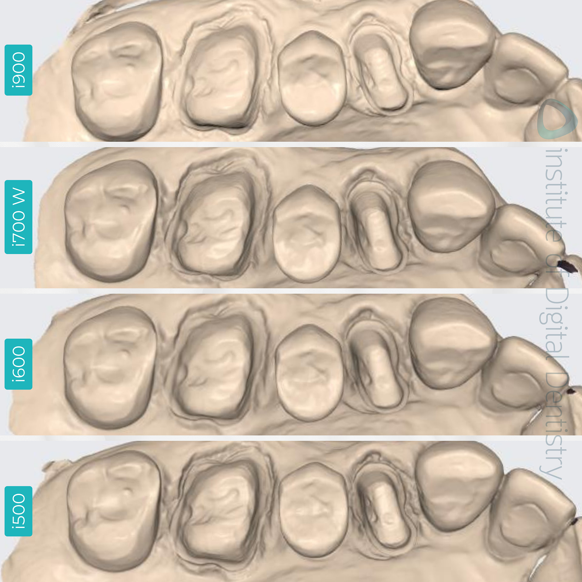 medit-intraoral-scanner-i500-i600-i700-wireless-i900-idd-compares-institute-of-digital-dentistry-native-monochrome-scan
