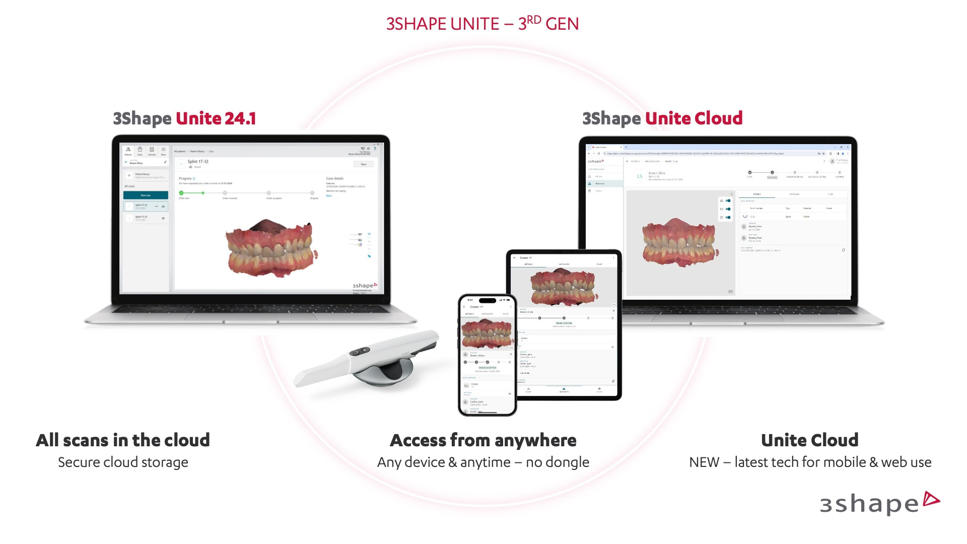 3Shape Unite 3rd Gen