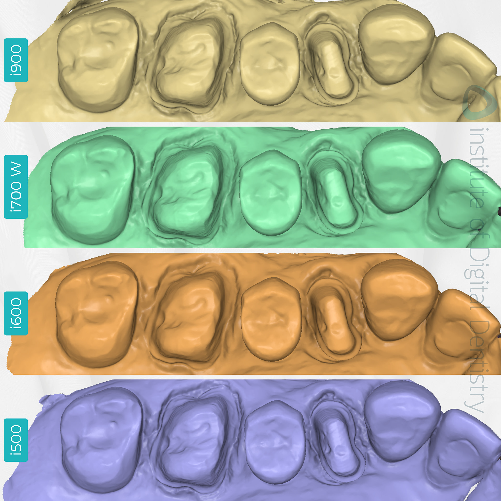 medit-intraoral-scanner-i500-i600-i700-wireless-i900-idd-compares-institute-of-digital-dentistry-medit-design-stl-scan