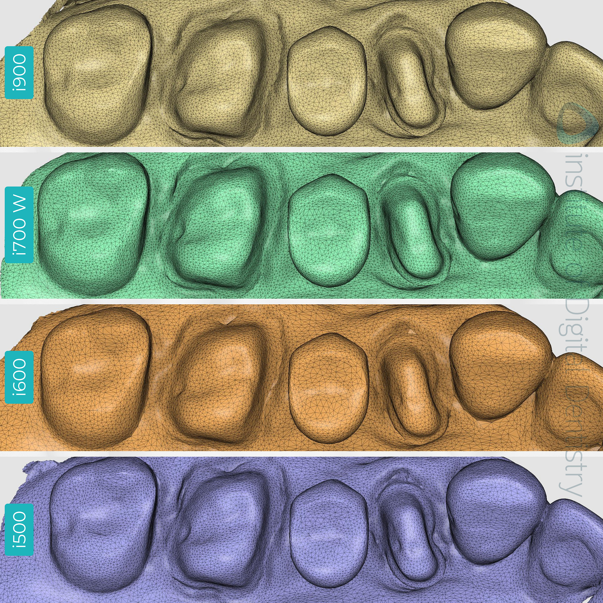 medit-intraoral-scanner-i500-i600-i700-wireless-i900-idd-compares-institute-of-digital-dentistry-blog-tessellated-mesh-stl-file-format-medit-design-software