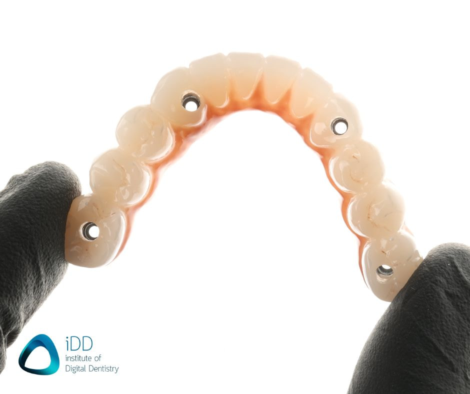 Full arch restoration