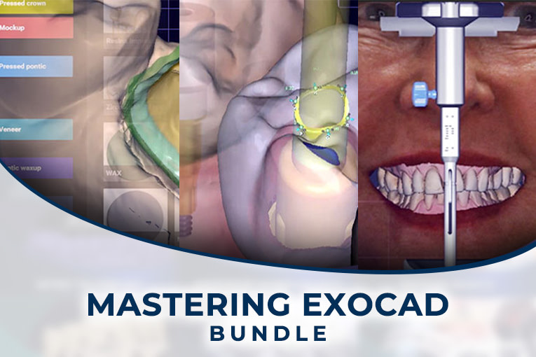 Mastering-exocad-bundle-spiffy-765x510