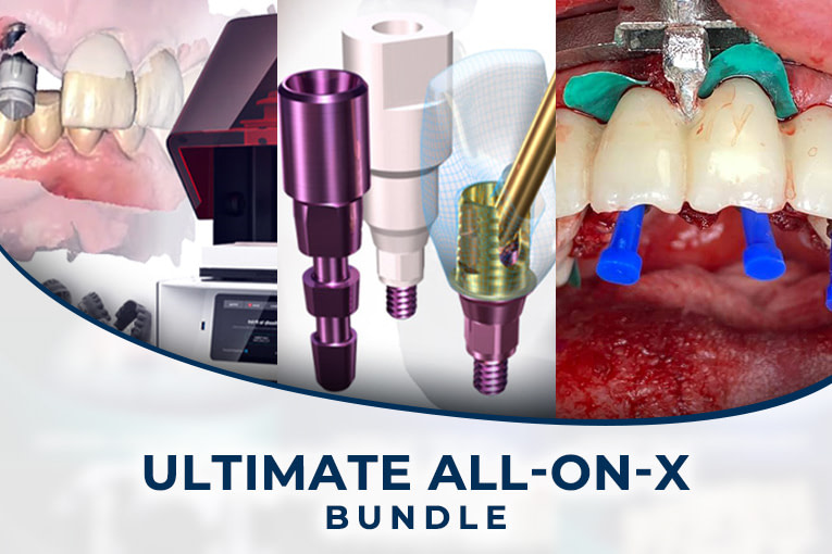 Ultimate-All-on-X-bundle-spiffy-765x510