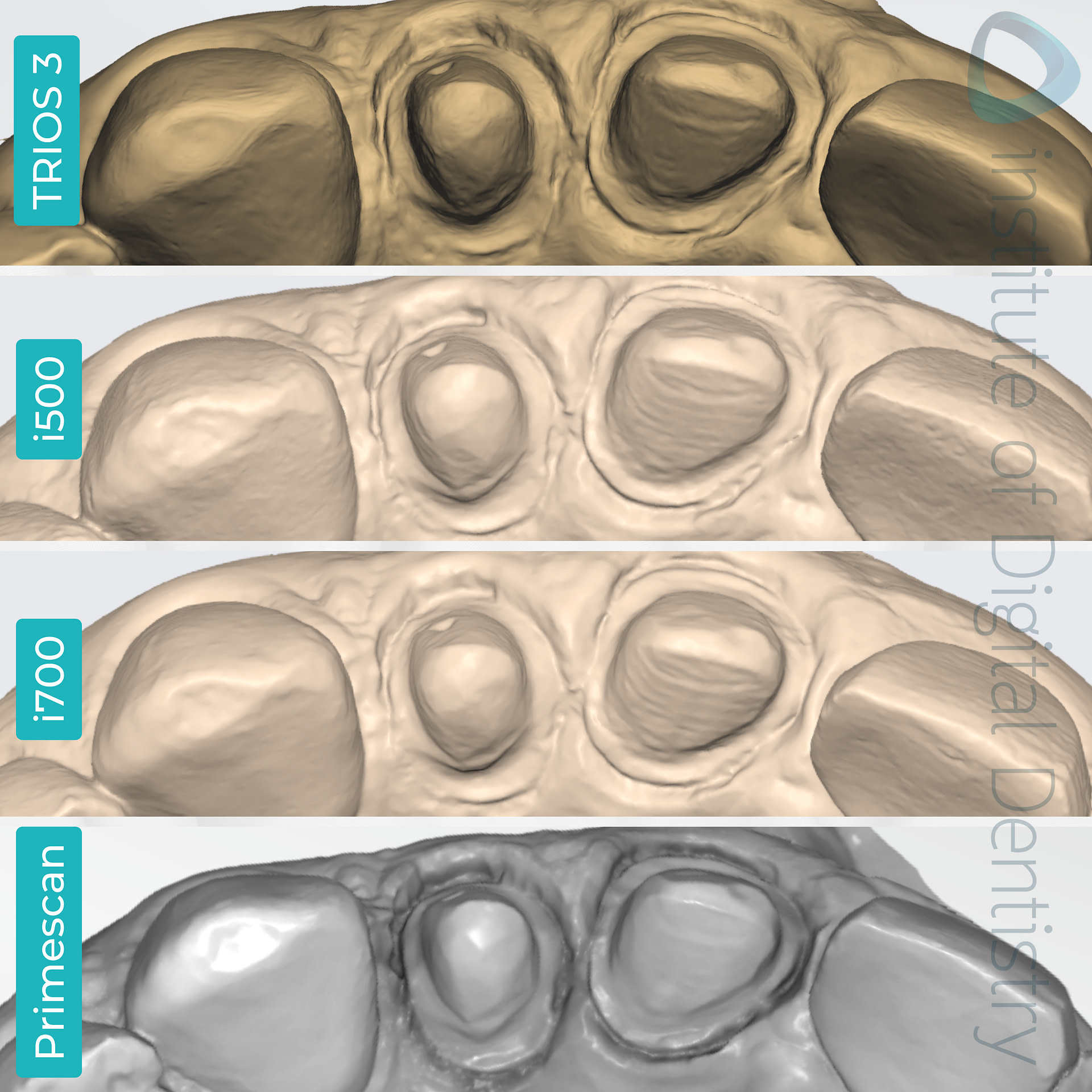 idd-compares-intraoral-scanners-3shape-trios3-medit-i500-i700-dentsply-sirona-cerec-primescan-monochrome-scan-native-software