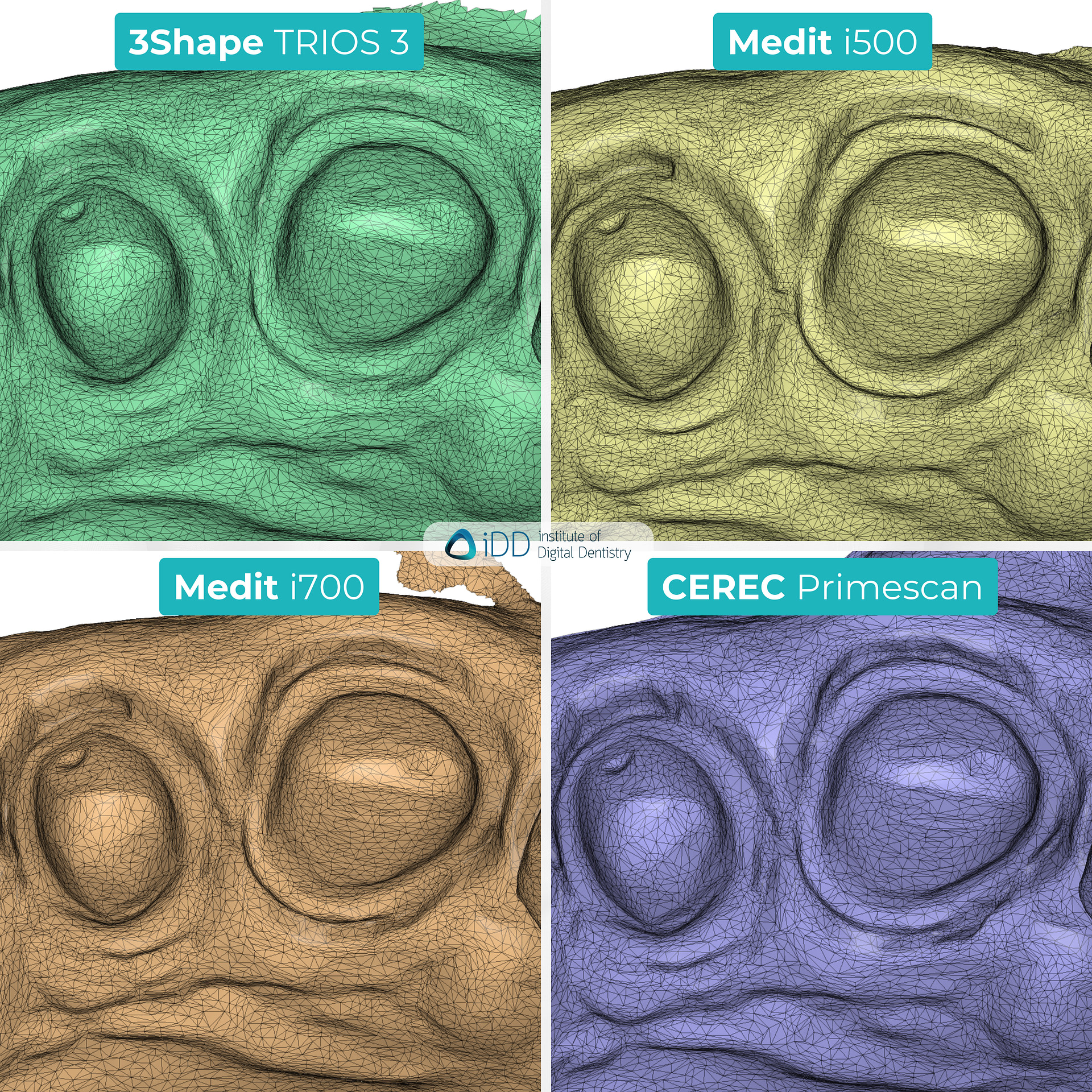 idd-compares-intraoral-scanners-3shape-trios3-medit-i500-i700-dentsply-sirona-cerec-primescan-tessellated-mesh