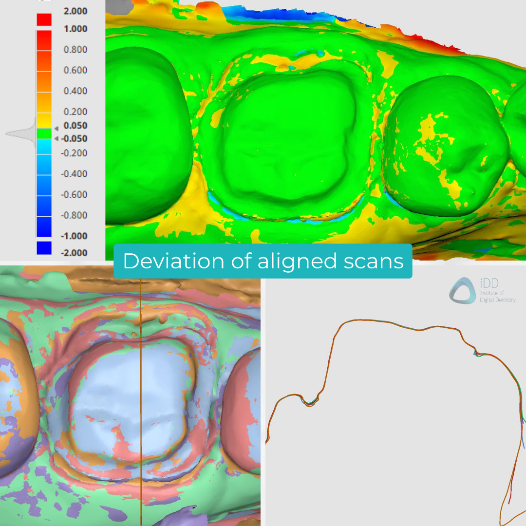 medit-i900-itero-lumina-cerec-primescan-3shape-trios-5-shining-3d-aoralscan-3-intraoral-scanner-idd-compares-institute-of-digital-dentistry-medit-design-deviation-accuracy