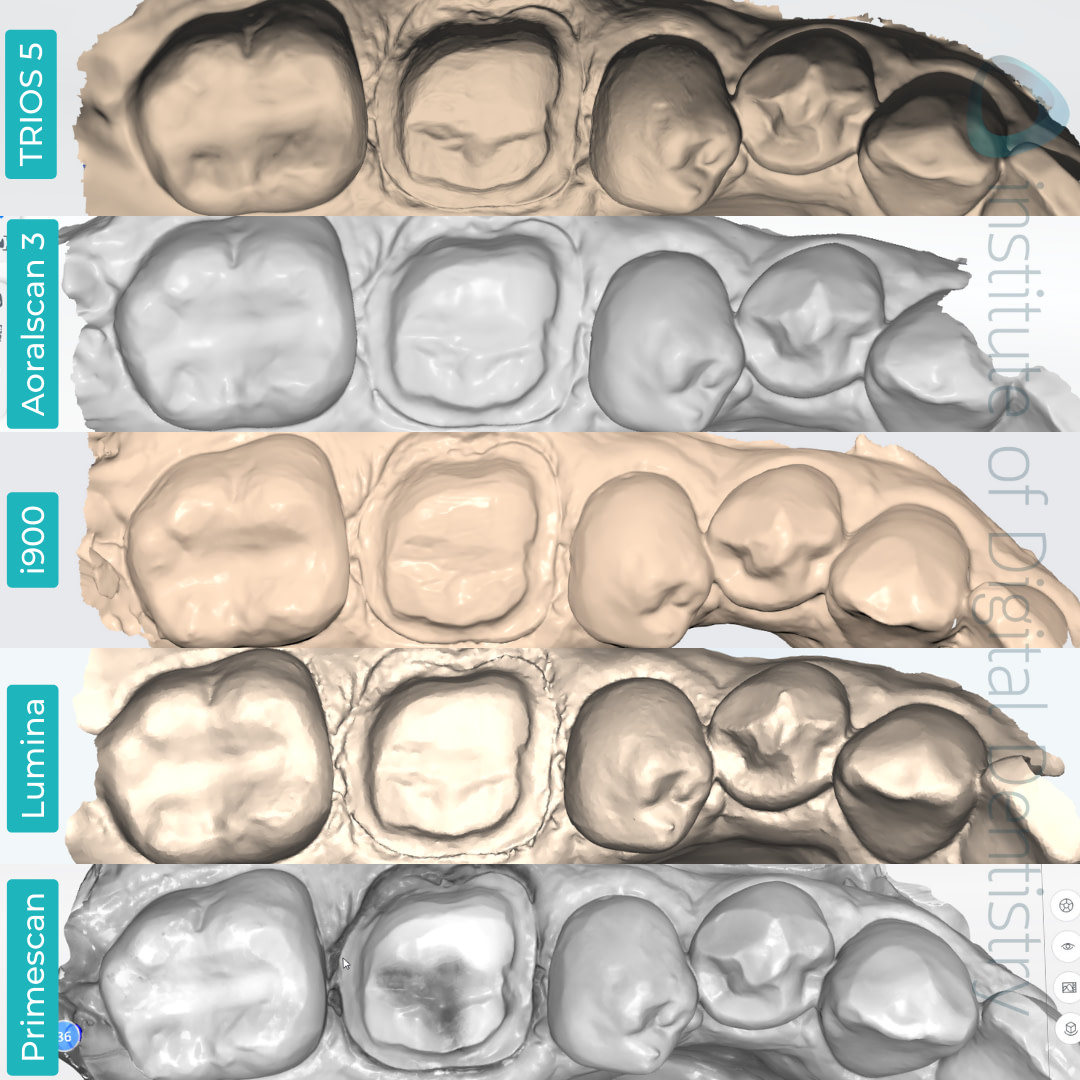 medit-i900-itero-lumina-cerec-primescan-3shape-trios-5-shining-3d-aoralscan-3-intraoral-scanner-idd-compares-institute-of-digital-dentistry-native-monochrome-scan