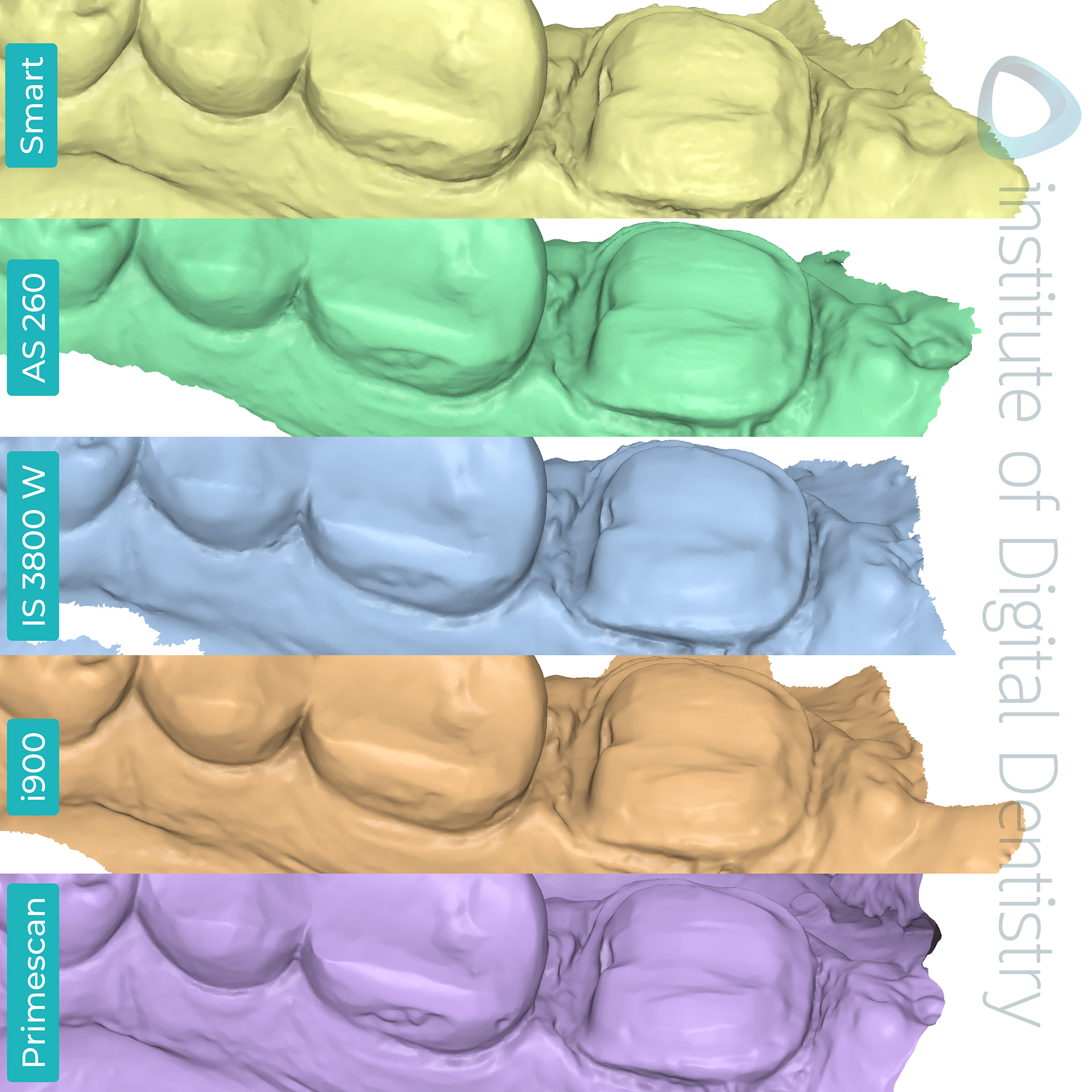 panda-smart-alliedstar-as260-dexis-is-3800-w-medit-i900-cerec-primescan-dentsply-sirona-idd-compares-institute-of-digital-dentistry-blog-medit-software-app-prep-margin-line-lingual-view