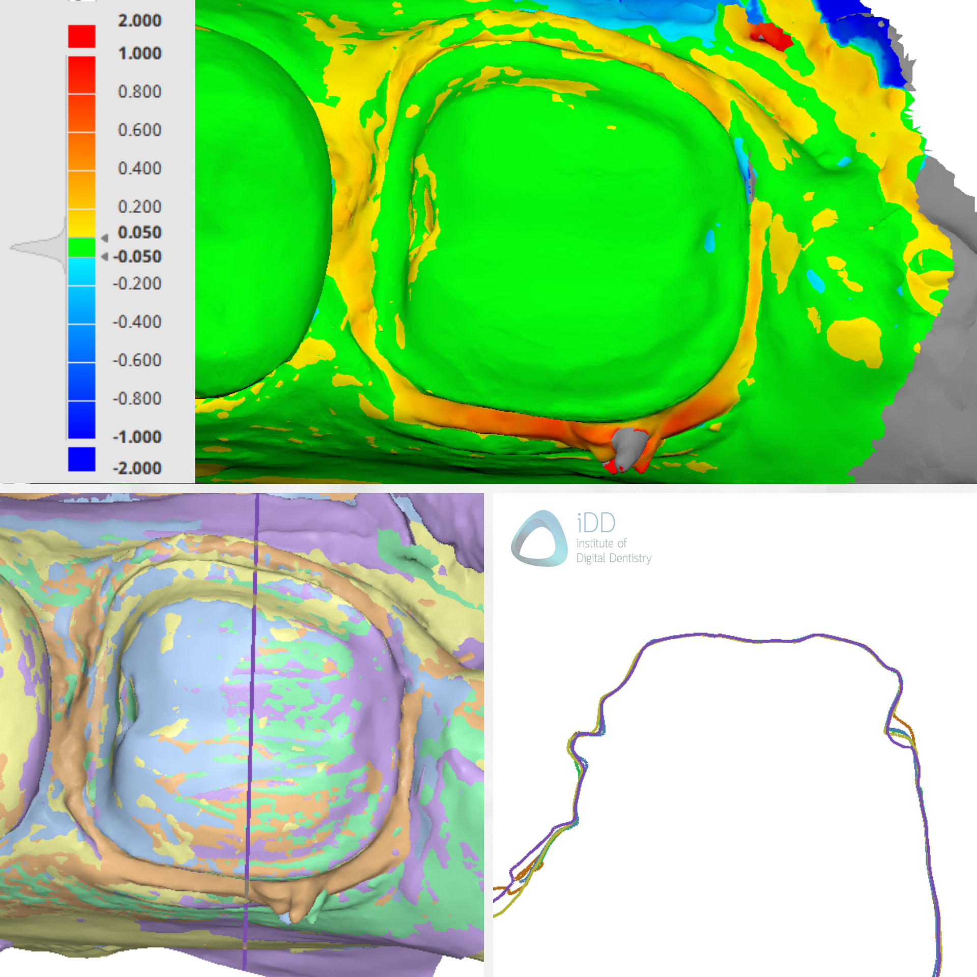 panda-smart-alliedstar-as260-dexis-is-3800-w-medit-i900-cerec-primescan-dentsply-sirona-idd-compares-institute-of-digital-dentistry-blog-medit-design-software-app-deviation-accuracy-alignment-scan-individual