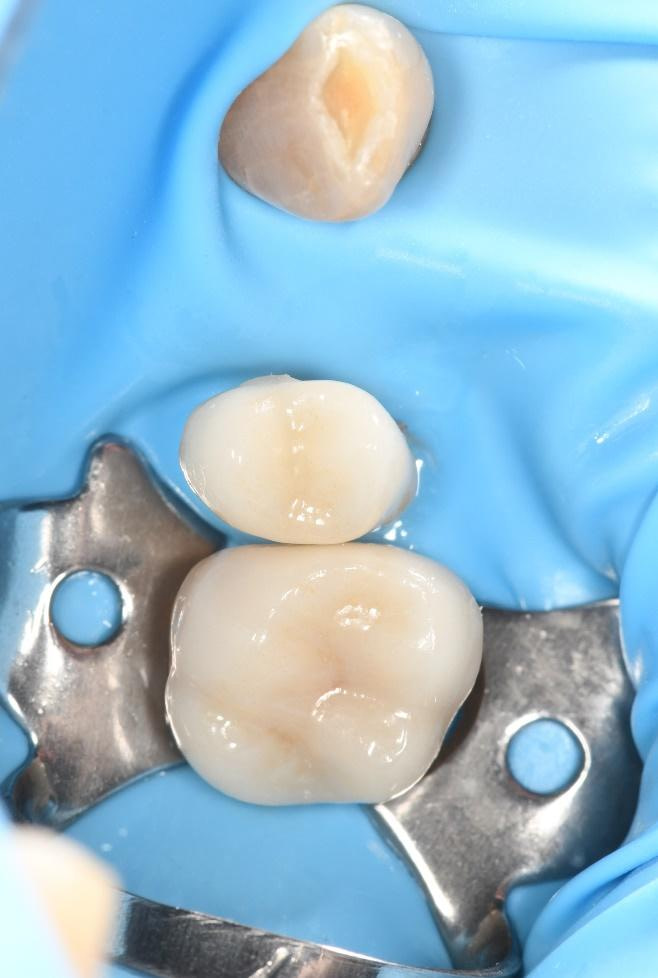 Byron Park 24 Implant 3Shape 4