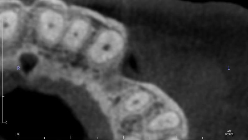 Byron Park 24 Implant 3Shape cbct 2