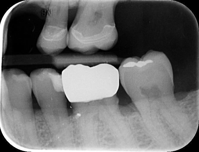 Byron Park 24 Implant 3Shape cbct 3