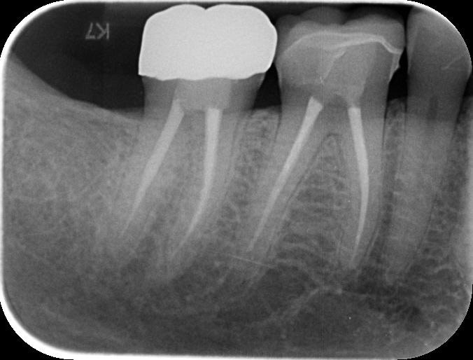 Byron Park 24 Implant 3Shape cbct