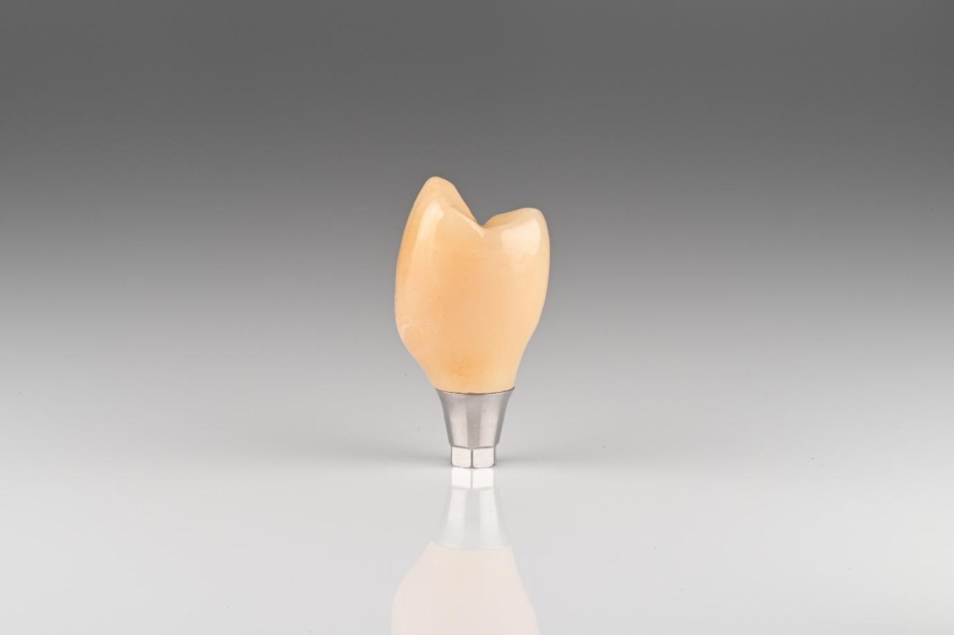 Crown is milled, sintered, stained, glazed, and cemented to the Ti base