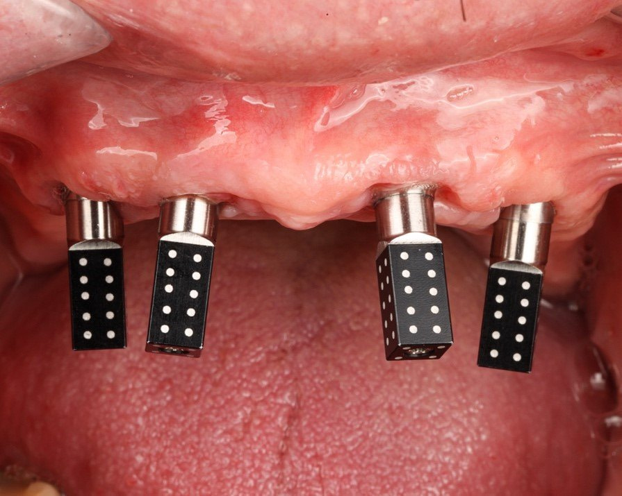 Fig.1+Photogrammetry+iMetric+iCAM