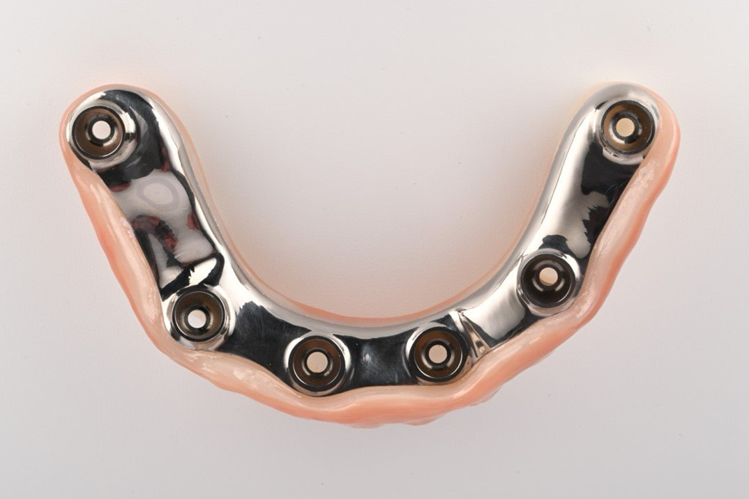 Fig.8+Tissue+and+Multi+Unit+Abutments+-+Final+Prosthese+Lower+Zirconia