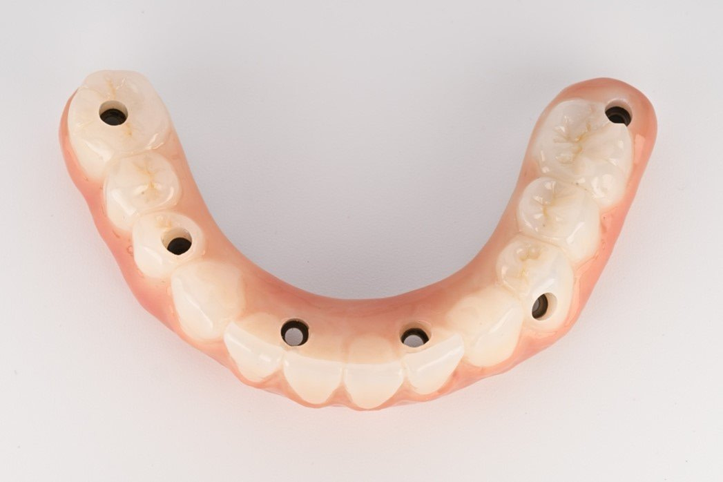 Fig.9+Tissue+and+Multi+Unit+Abutments+-+Final+Prosthesis+Lower+Zirconia