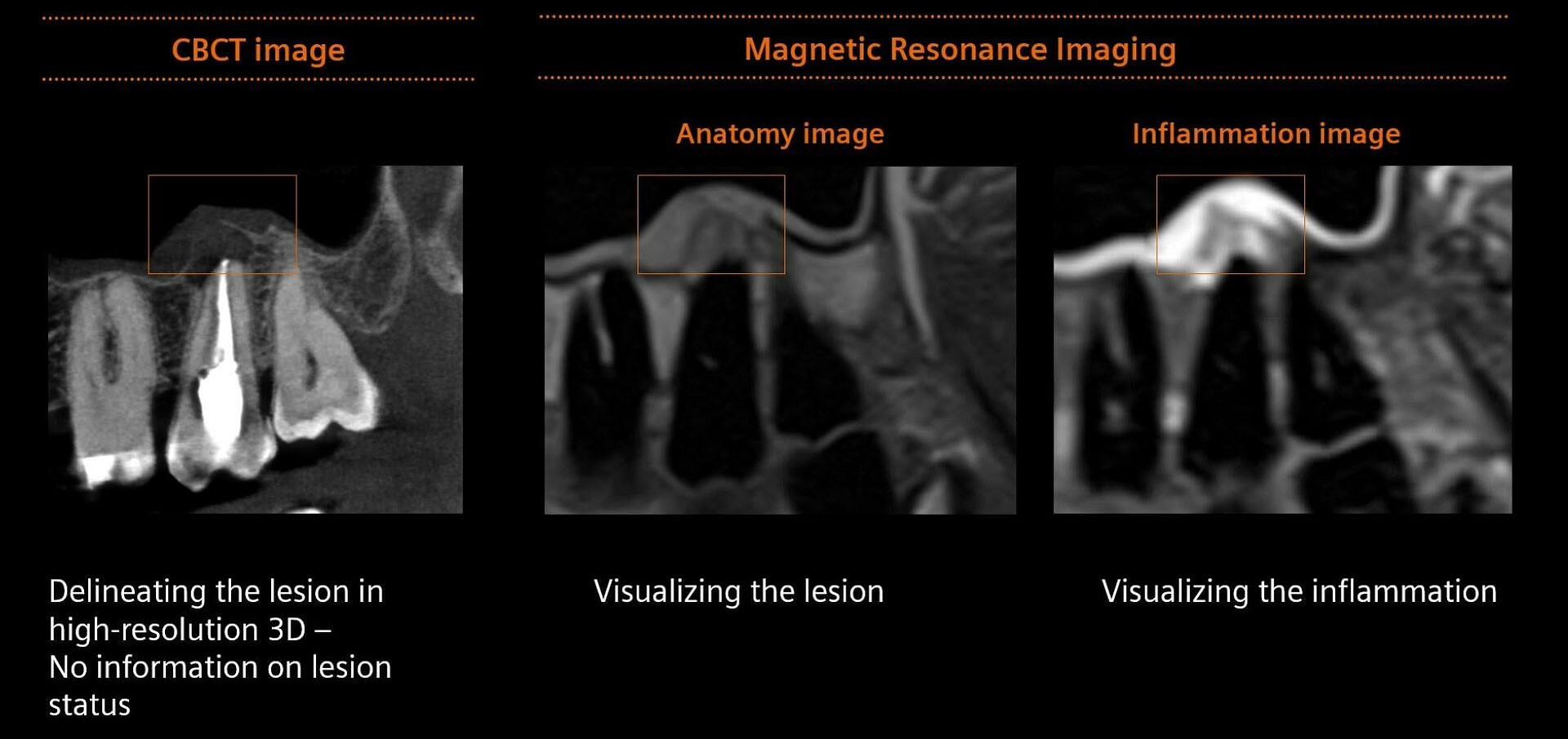 clinical-image-siemens-healthineers-dental-mri-Clinical-Evidence-inflammation-idd-blog