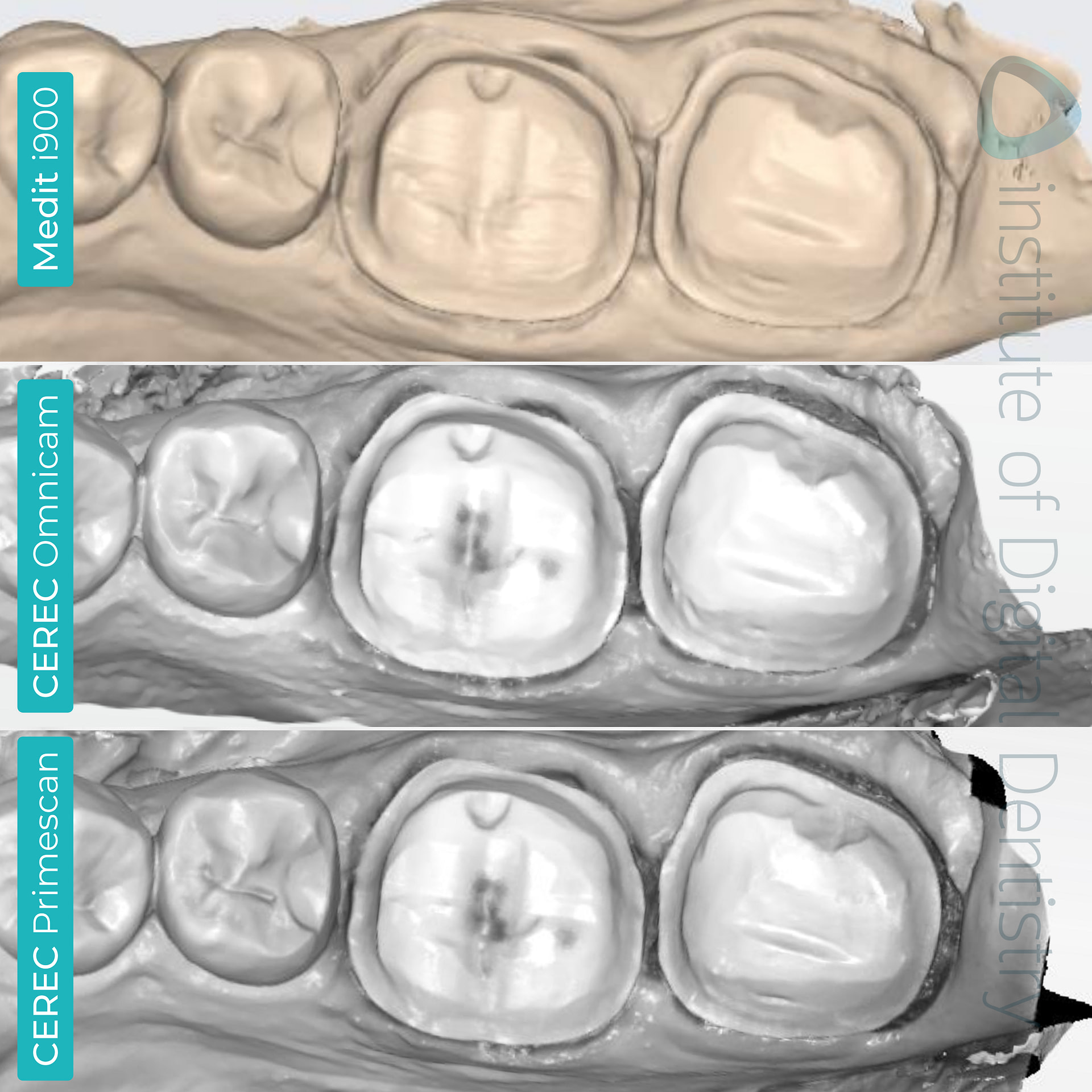 medit-i900-cerec-omnicam-cerec-primescan-dentsply-sirona-idd-compares-institute-of-digital-dentistry-blog-native-software-monochrome-scans
