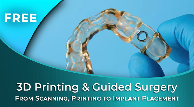 3D-printing-and-guided-implant-surgery-FormLabs-iDD-free