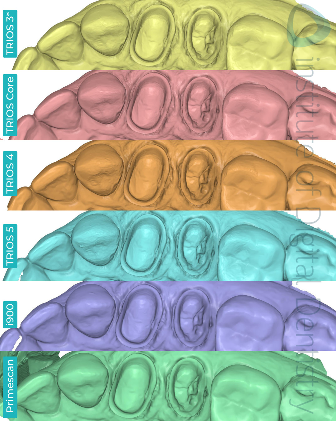 3shape-trios-3-updated-4-5-core-medit-i900-dentsply-sirona-cerec-primescan-intraoral-scanner-institute-of-digital-dentistry-idd-compares-blog-medit-design-app-stl-file-format