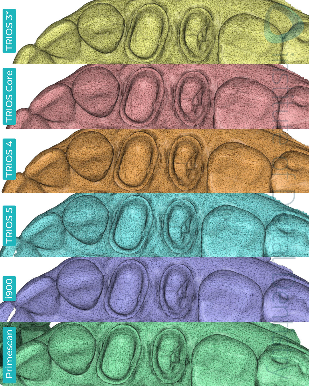 3shape-trios-3-updated-4-5-core-medit-i900-dentsply-sirona-cerec-primescan-intraoral-scanner-institute-of-digital-dentistry-idd-compares-blog-medit-design-app-stl-file-format-tessellation-mesh-density