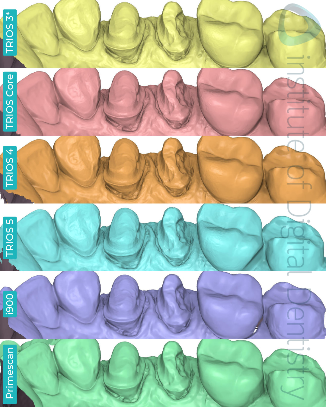 3shape-trios-3-updated-4-5-core-medit-i900-dentsply-sirona-cerec-primescan-intraoral-scanner-institute-of-digital-dentistry-idd-compares-blog-medit-design-app-stl-file-format-margin-prep-line-palatal-view