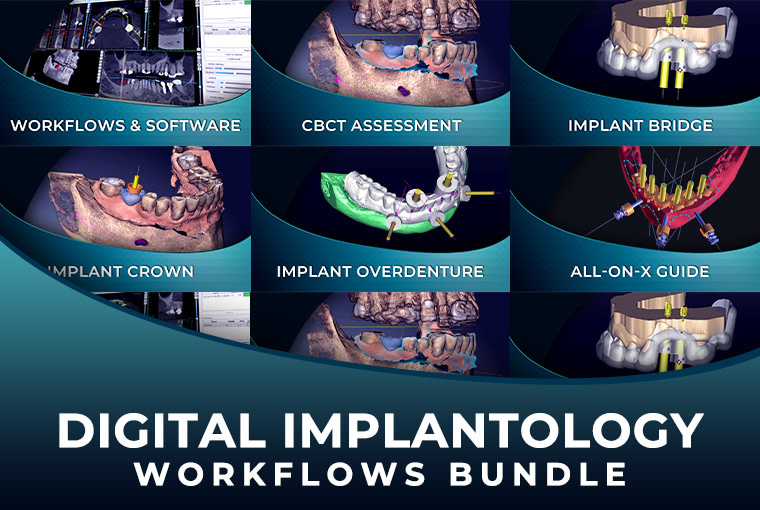 Digital-Implantology-Workflows-bundle-spiffy-765x510
