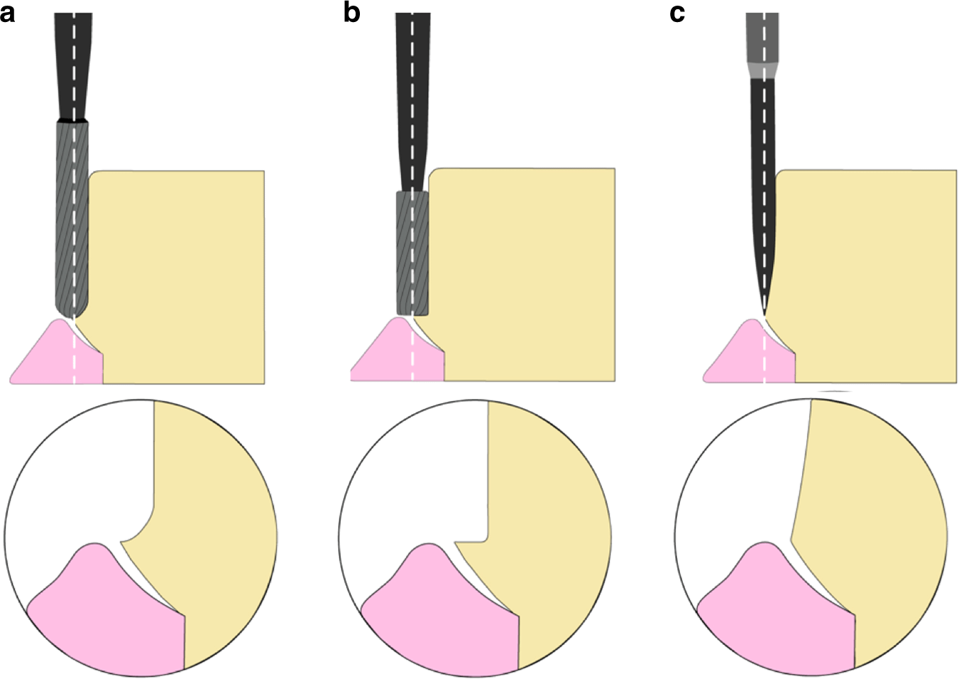 Rounded prep-Margin designs