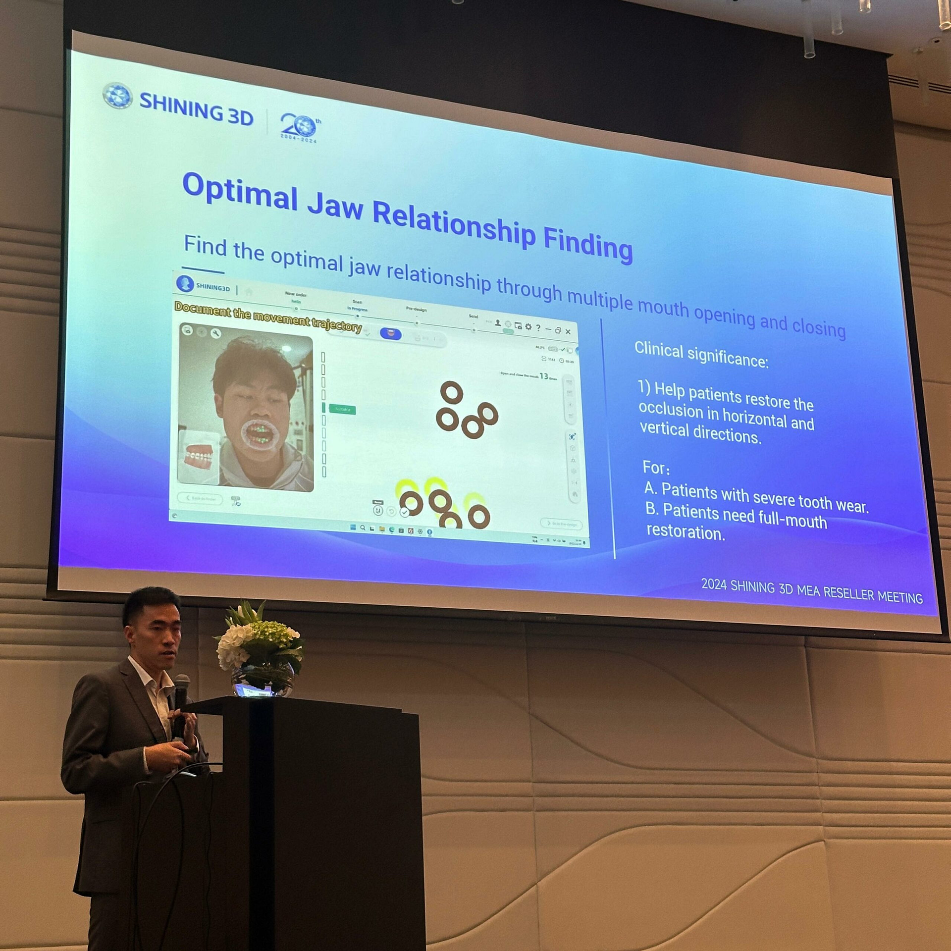 Shining 3D MEA event new intraoral scanner elite 1 (3)