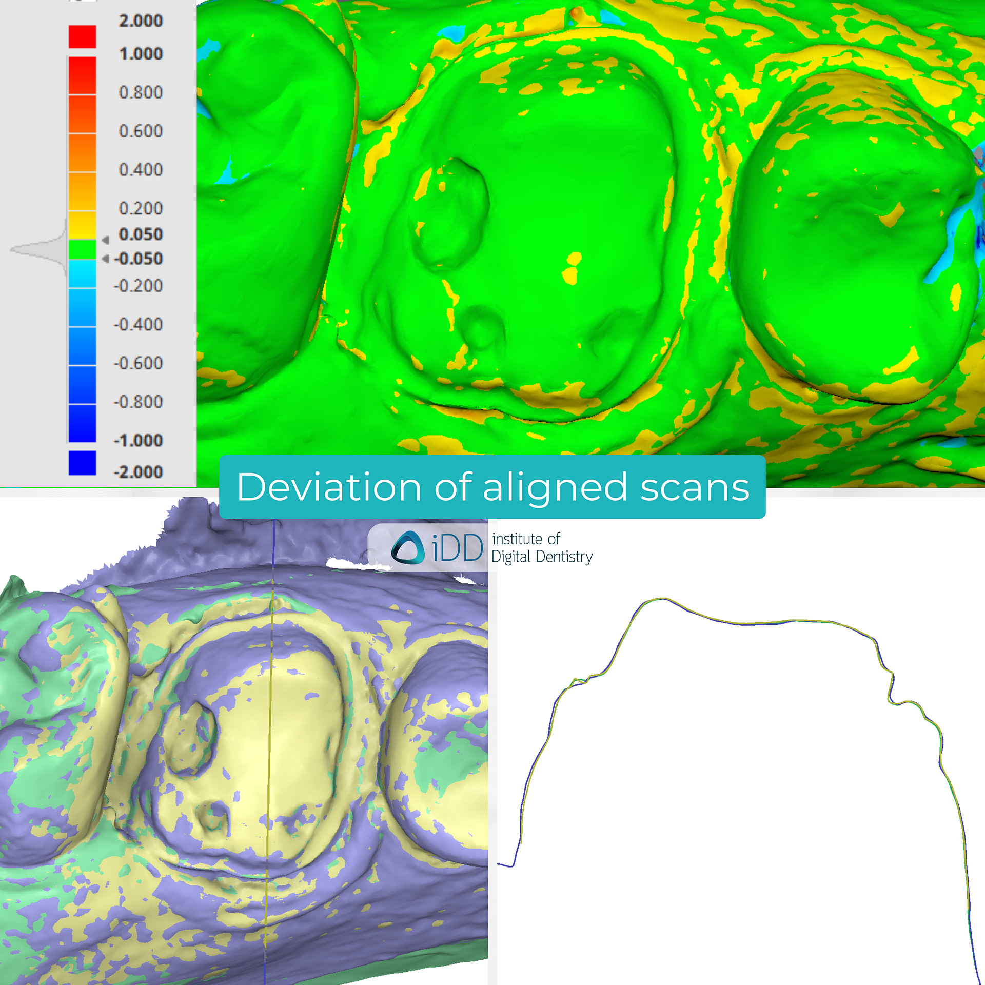 panda-smart-dexis-is-3800-w-cerec-primescan-dentsply-sirona-medit-design-software-stl-file-scan-deviation-alignment-accuracy-idd-compares-institute-of-digital-dentistry-blog