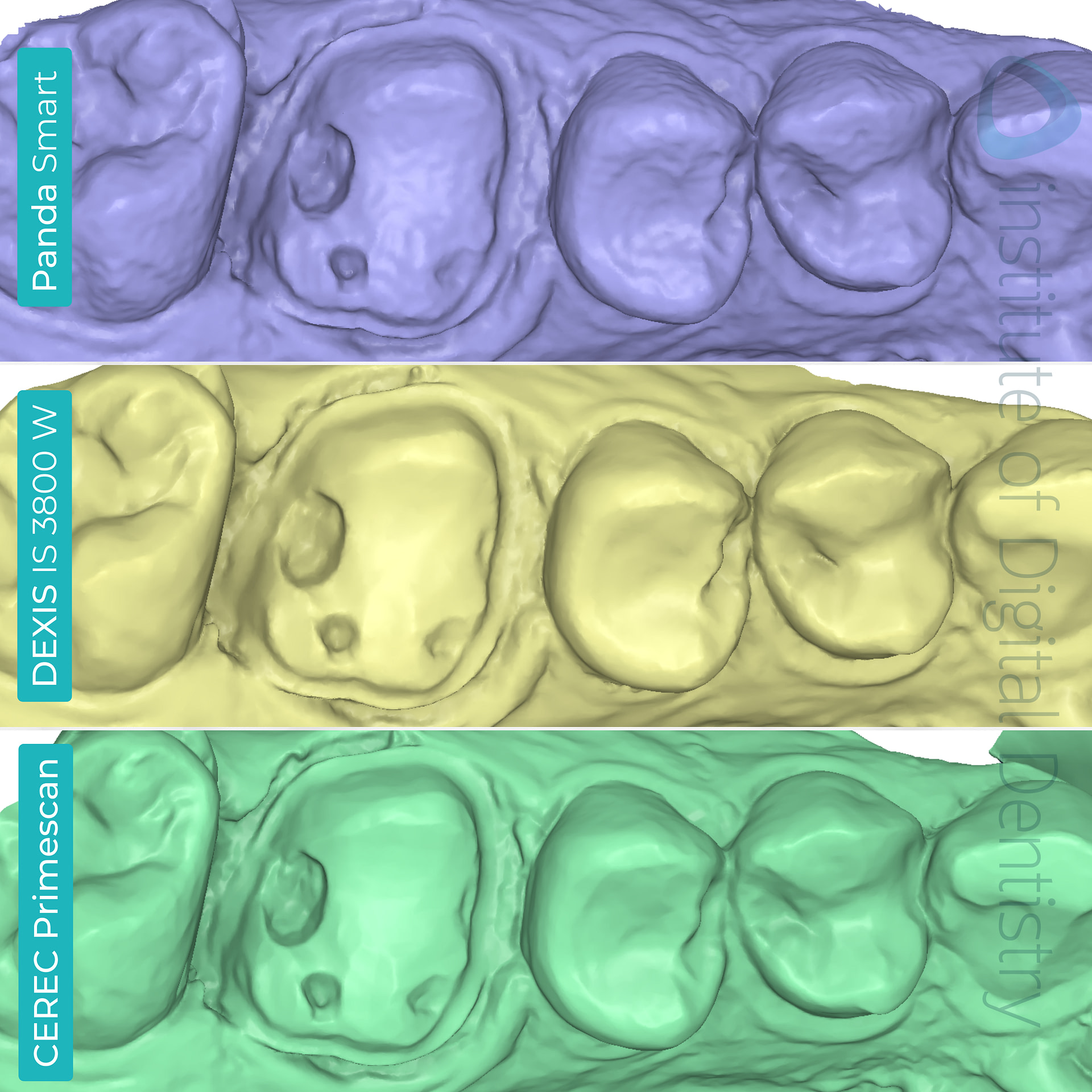 panda-smart-dexis-is-3800-w-cerec-primescan-dentsply-sirona-medit-design-software-stl-file-scan-idd-compares-institute-of-digital-dentistry-blog